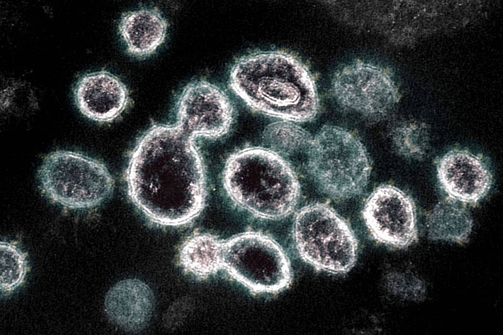 Primeiro caso da variante XBB.1.5 do coronavírus é identificado no interior de SP